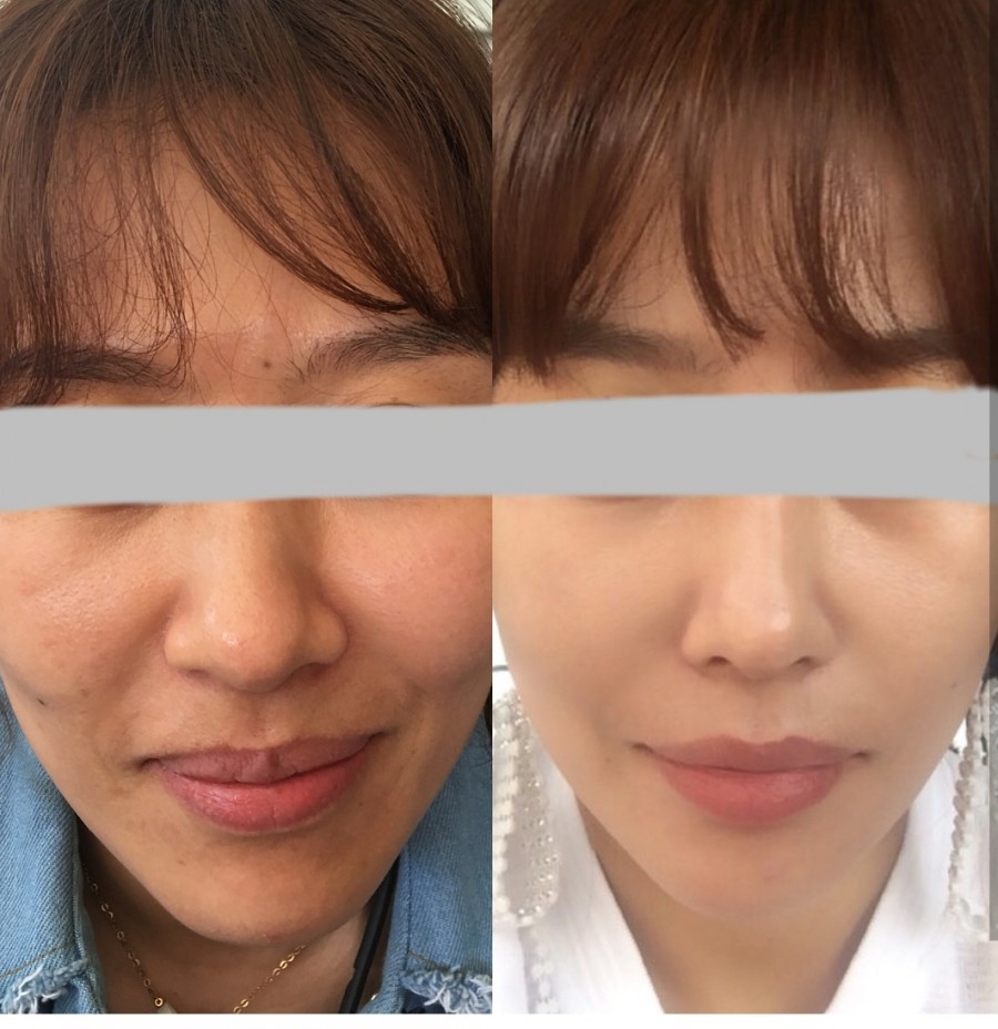 로덱스화장품 이미지