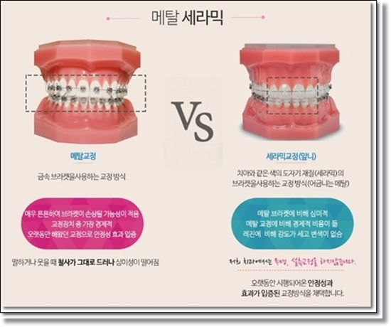 참좋은치과의원 이미지