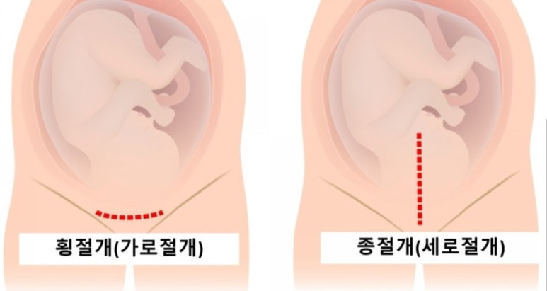 쎈바디운동센터 이미지