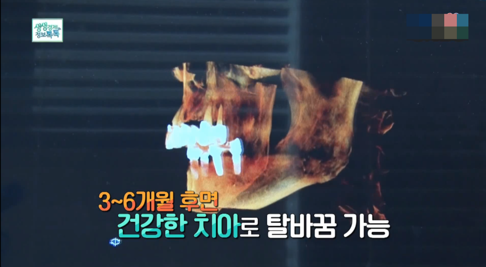 바른우리치과 이미지