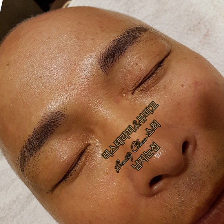 렉스테라피 이미지