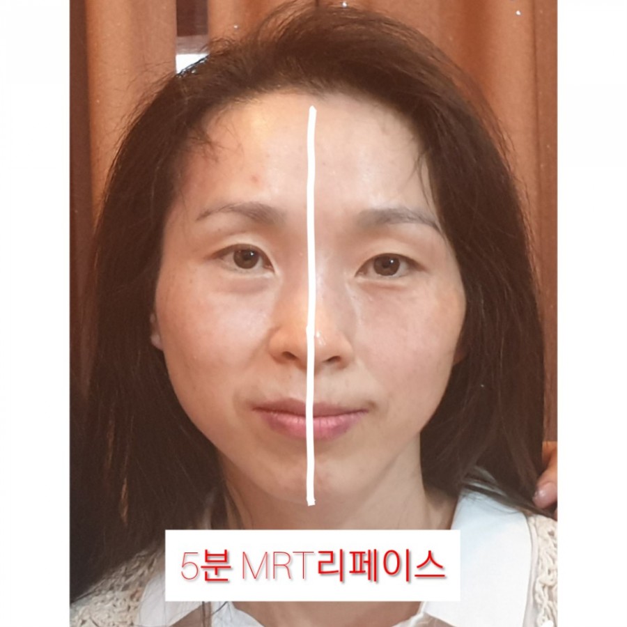 수기테라피 이미지