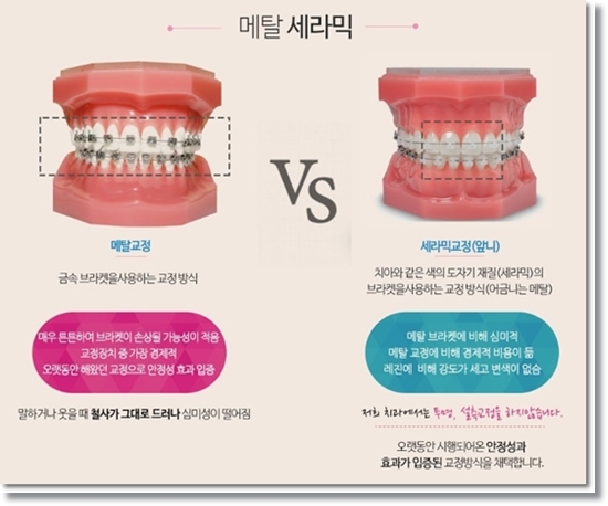 참좋은치과의원 이미지