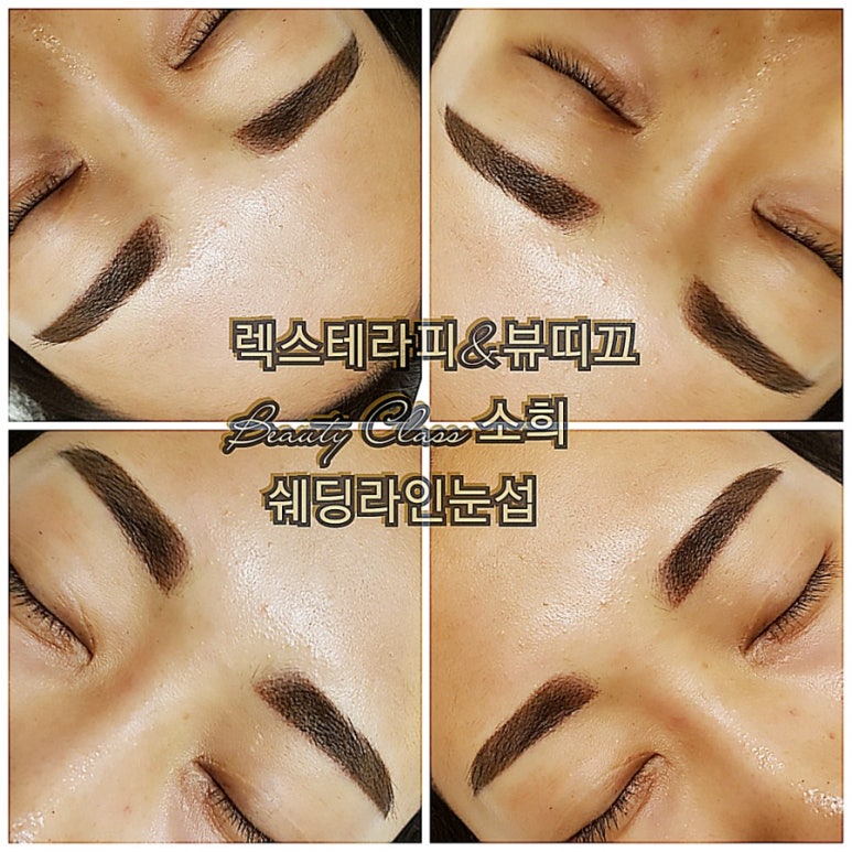 렉스테라피 이미지