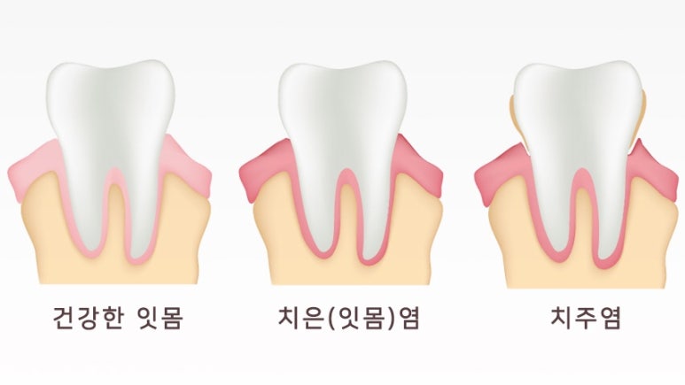 서울굿모닝치과 이미지