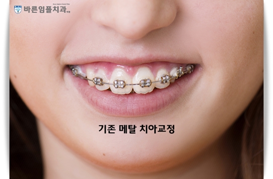 우리가족치과 이미지
