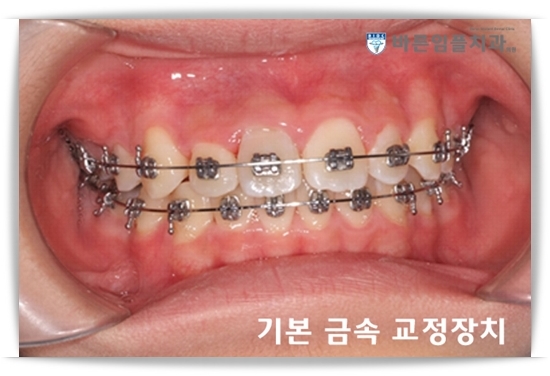우리가족치과 이미지