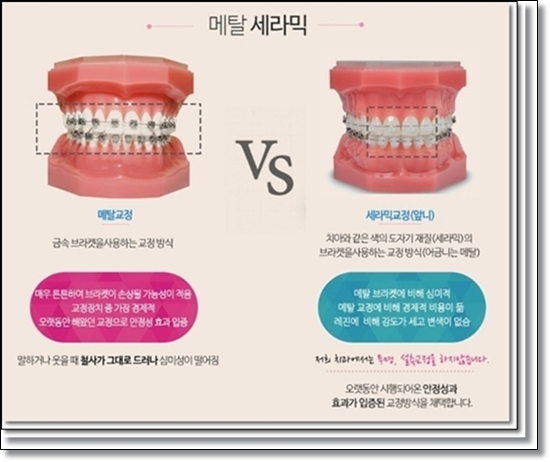 우리가족치과 이미지