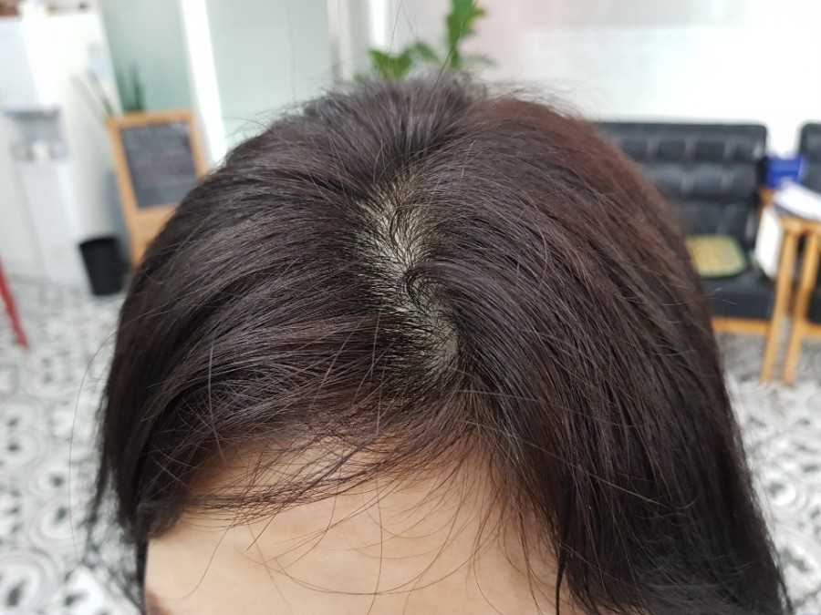 알케이 이미지