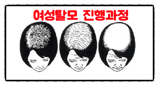 올맨 이미지