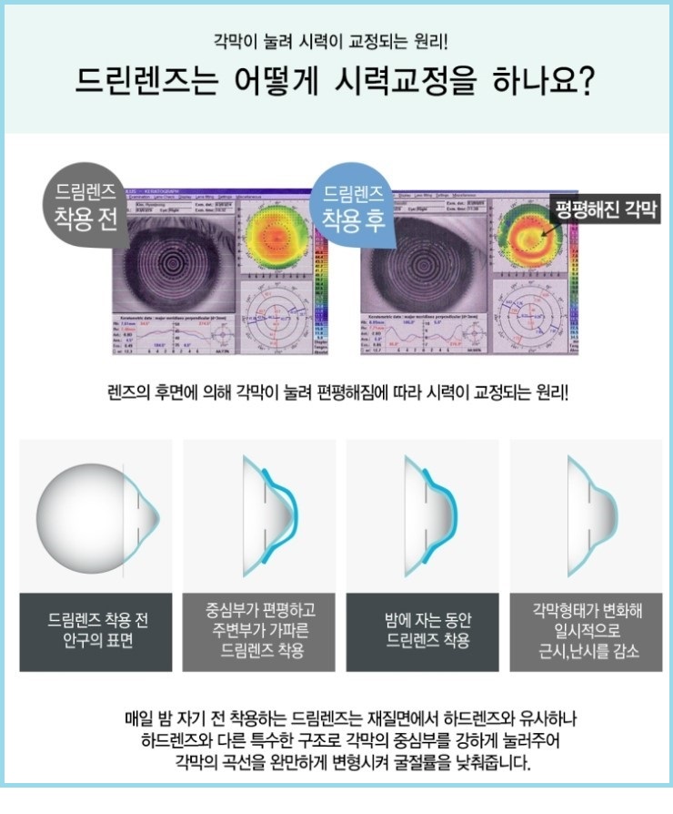 새봄안과 이미지