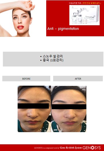 황실피부 이미지