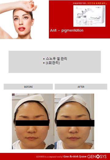 황실피부 이미지