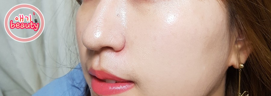 바른메디케어 이미지