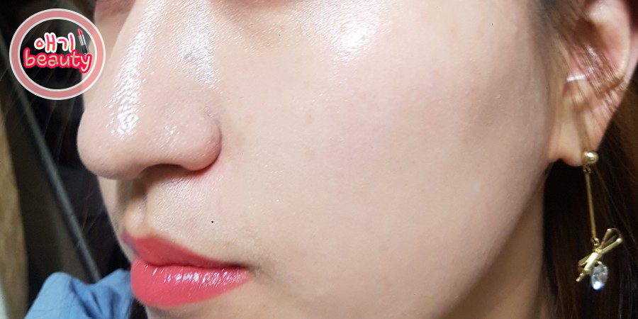 바른메디케어 이미지