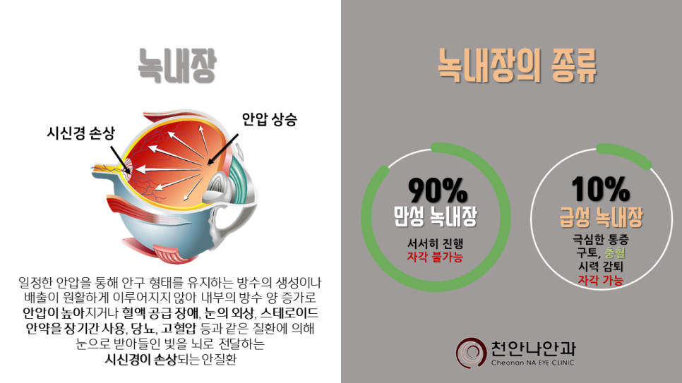 천안나안과의원 이미지
