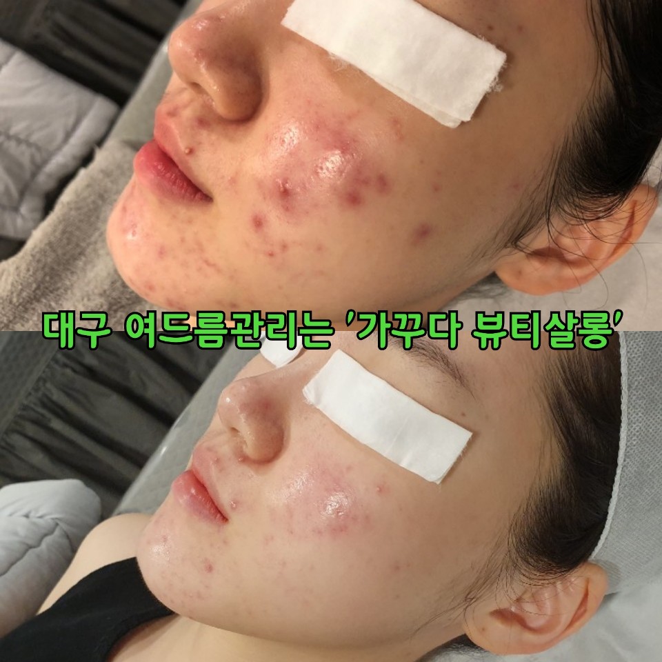 가꾸다뷰티 이미지