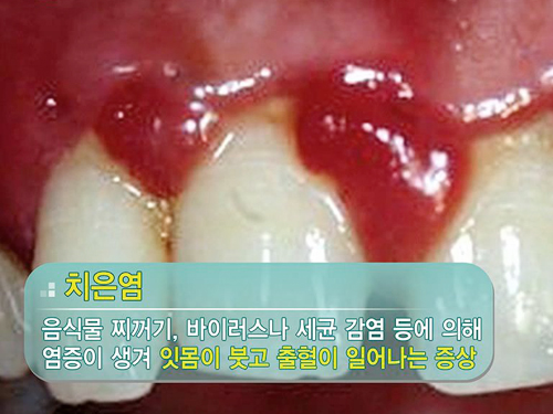 프렌즈치과 이미지