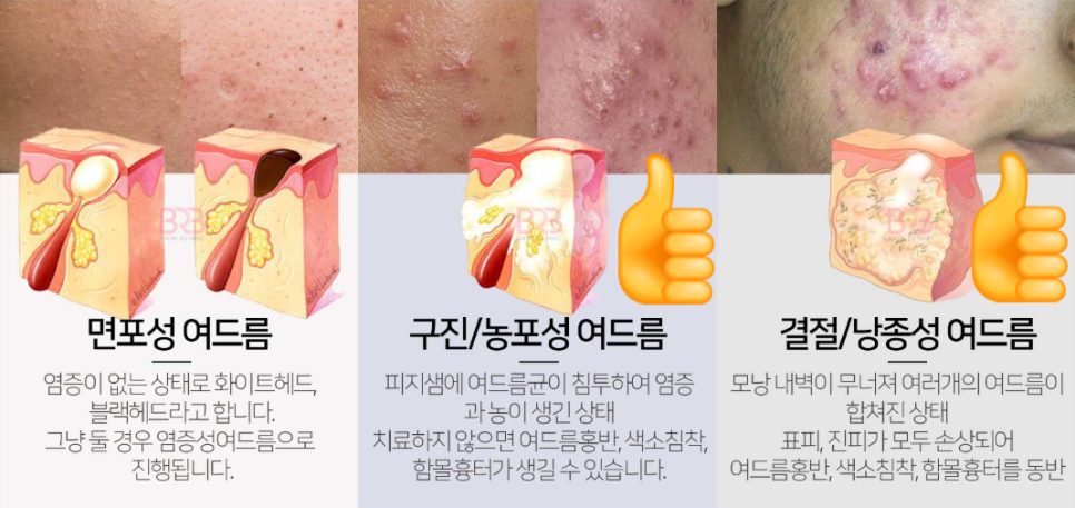 바라봄피부과 이미지