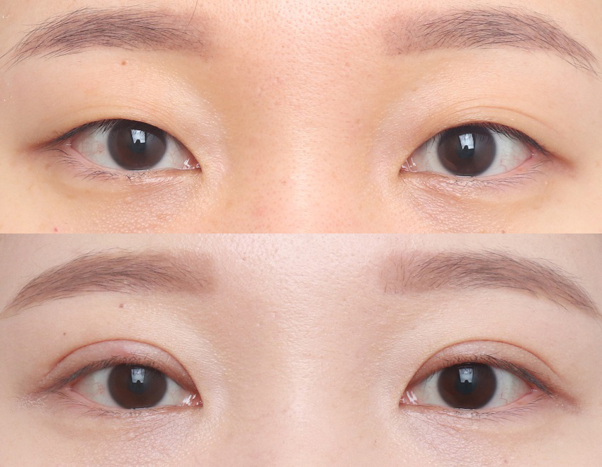 네이처성형외과 이미지
