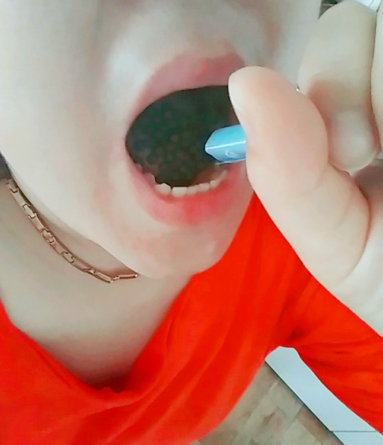 웰라핏 이미지