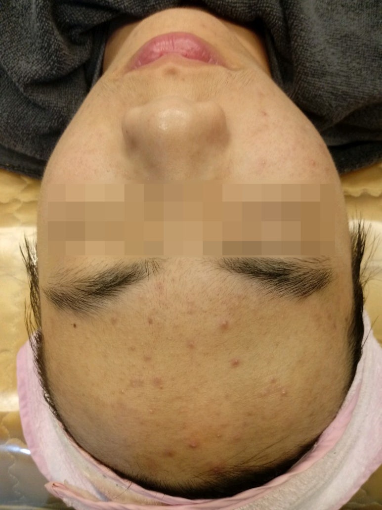 유니나 피부관리 이미지