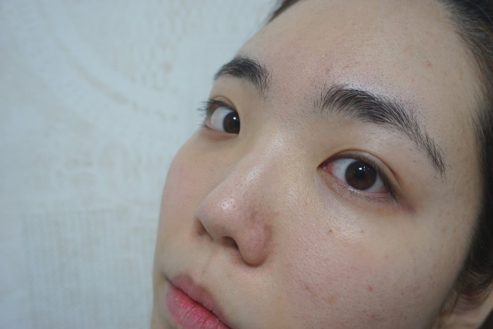 바른메디케어 이미지