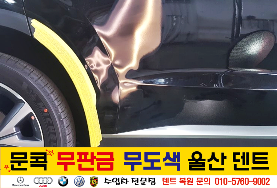 덴트핀다 이미지