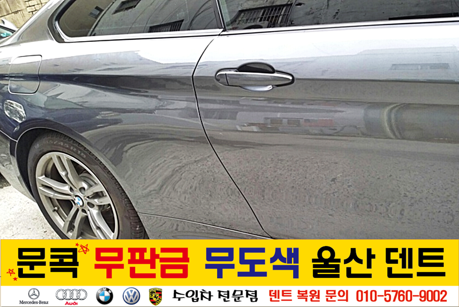 덴트핀다 이미지