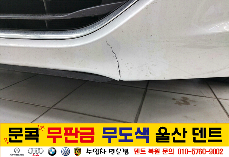 덴트핀다 이미지