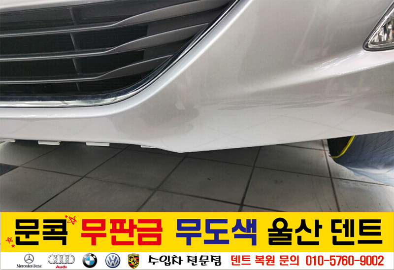 덴트핀다 이미지
