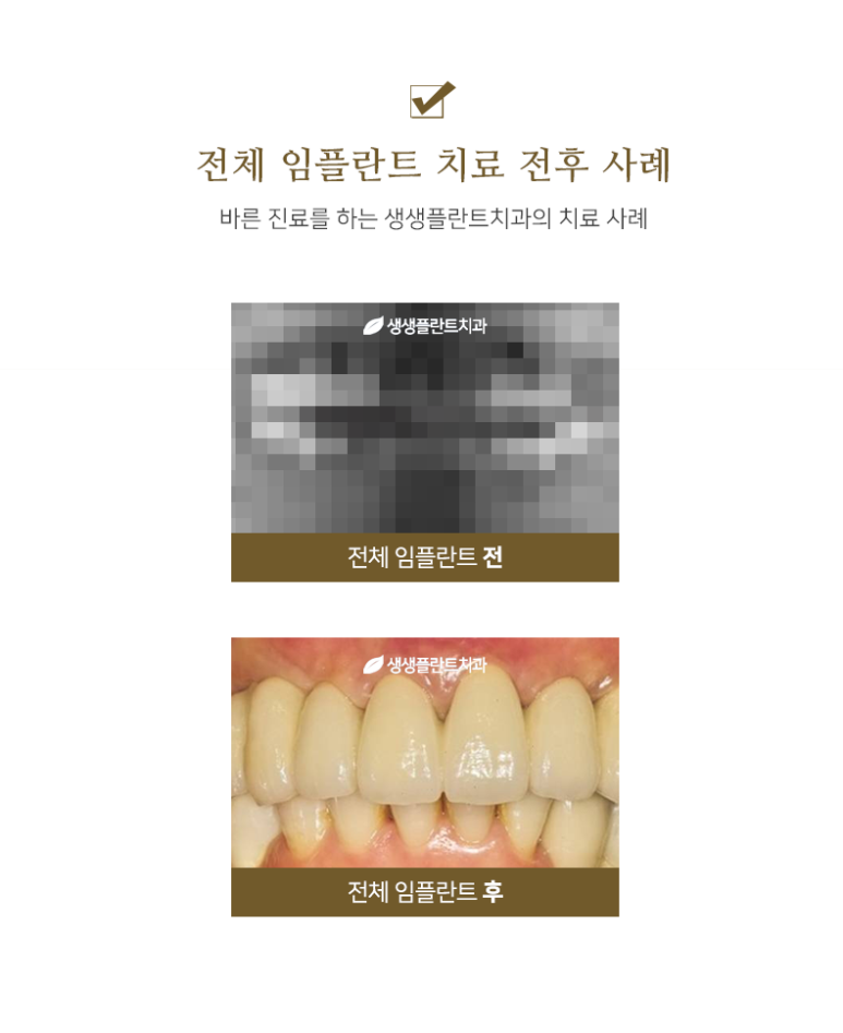 아임플란트치과의원 이미지