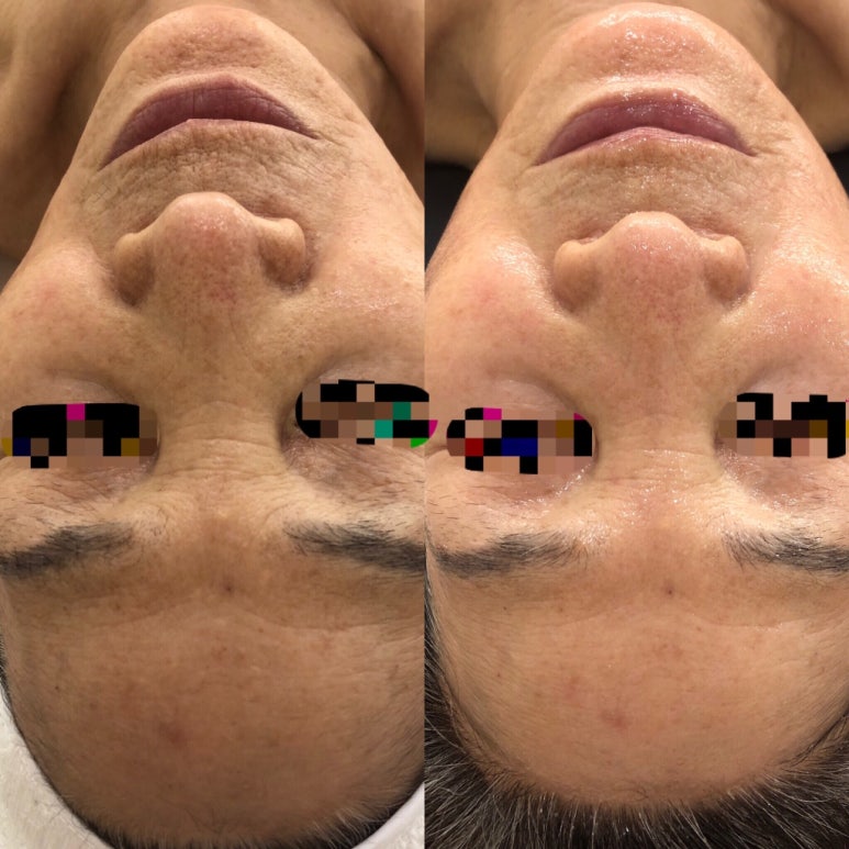 뷰티호텔 이미지