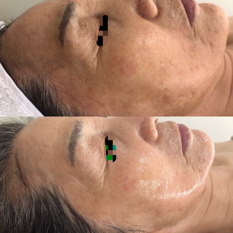 뷰티호텔 이미지