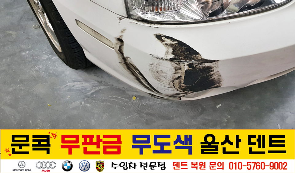 덴트핀다 이미지