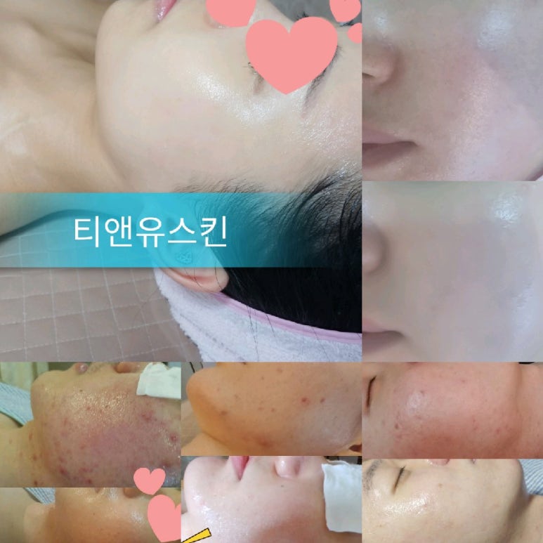 성피부관리실 이미지