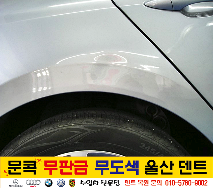 덴트핀다 이미지