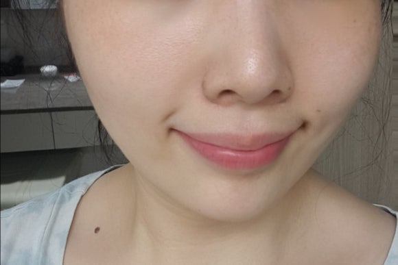 에스알케어 이미지