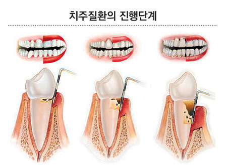 서울테라치과 이미지