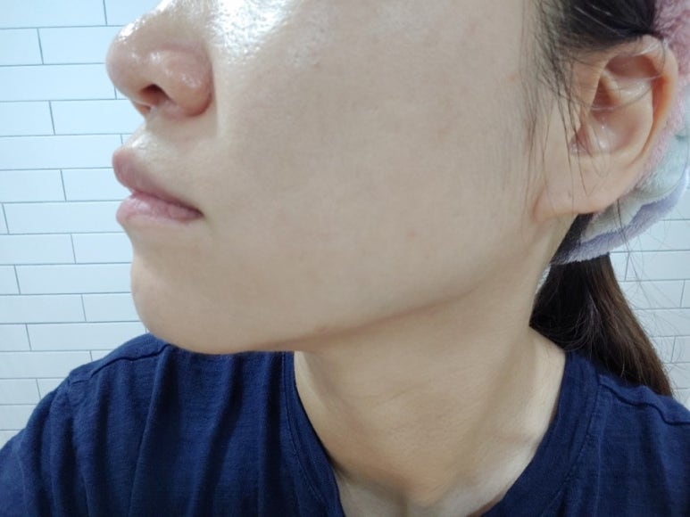 더마존 코리아 이미지