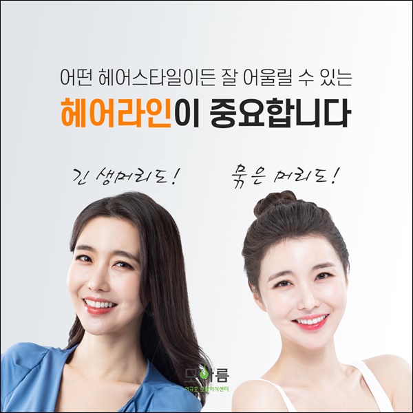 장헤어라인 이미지