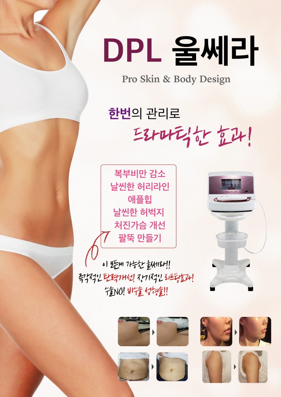 디피엘 이미지