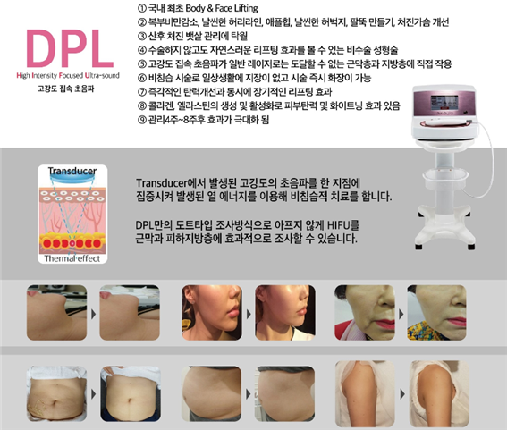 디피엘 이미지