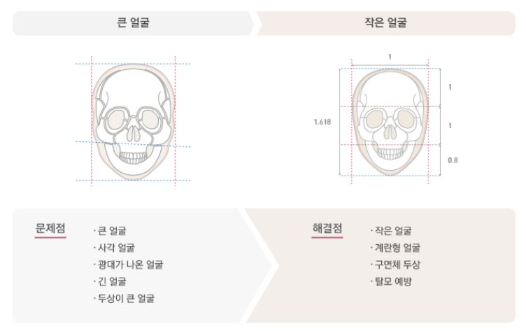 명가약손 이미지