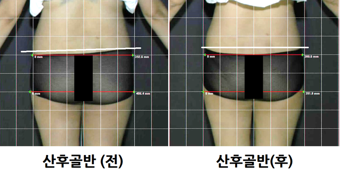 영에스테틱 이미지