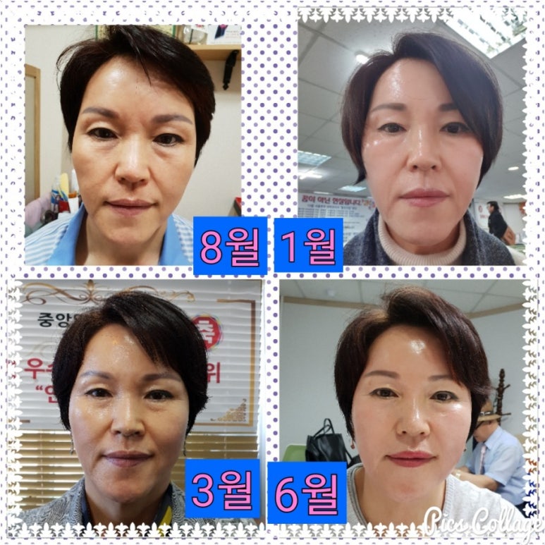 인셀덤샤인 이미지