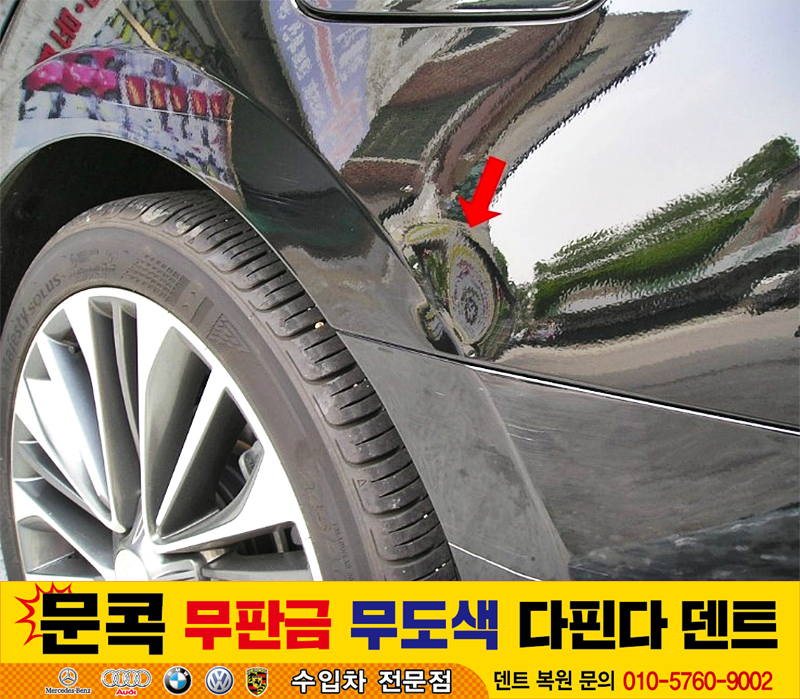 덴트핀다 이미지