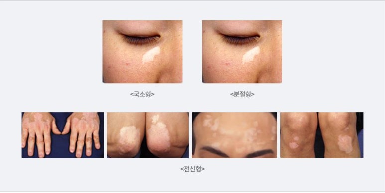 연세피부비뇨기과 이미지