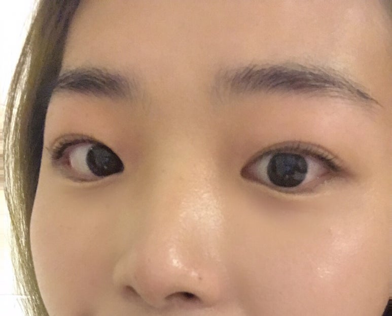 린뷰티 이미지