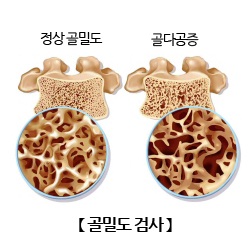 가로수짐 이미지